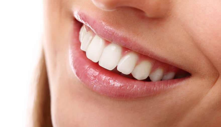 Atención: Estos 5 alimentos también dañan tus dientes